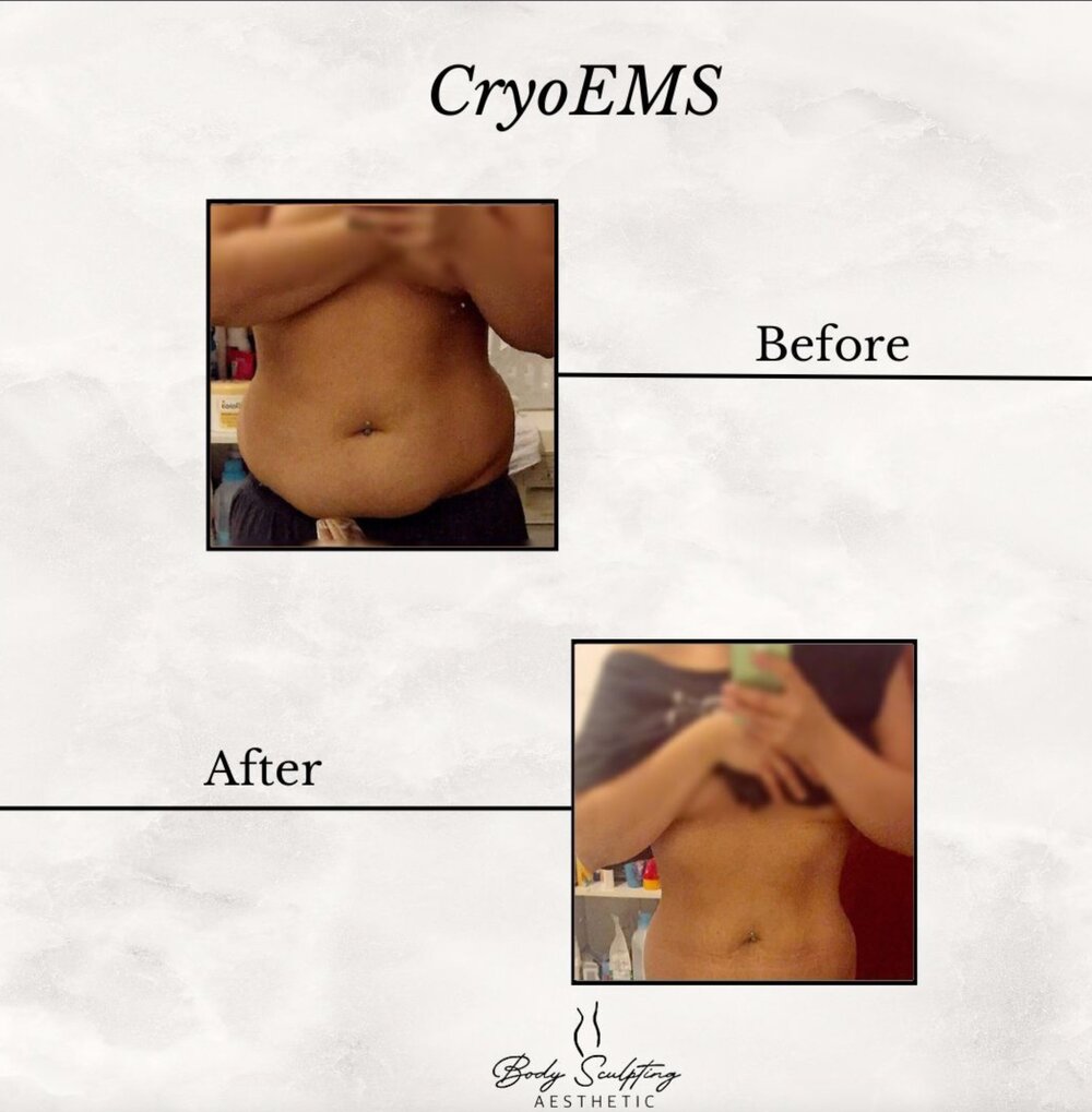 CryoEMS before and after